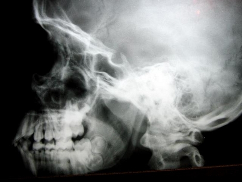 skullCN9695